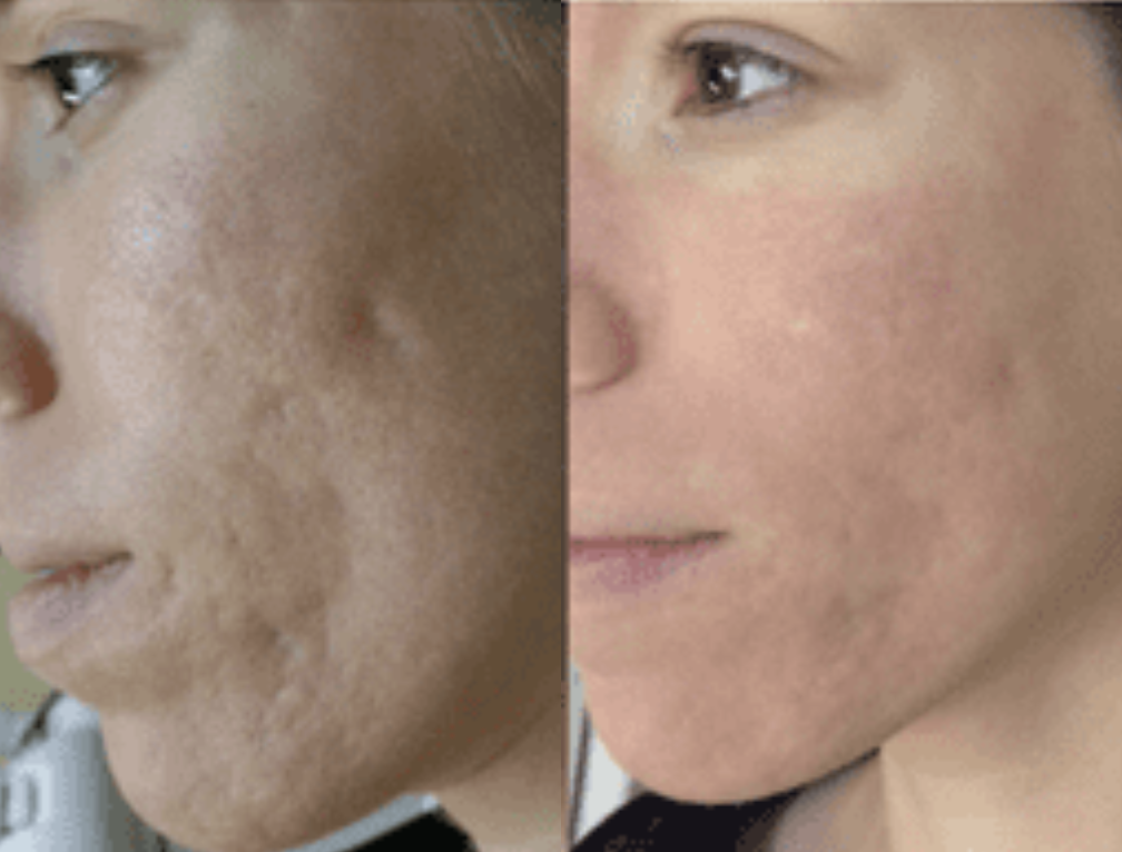 Testimonials – Britney Suriel