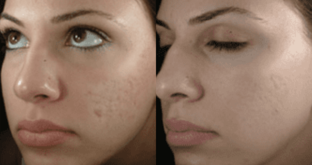 Testimonials – Delenia More
