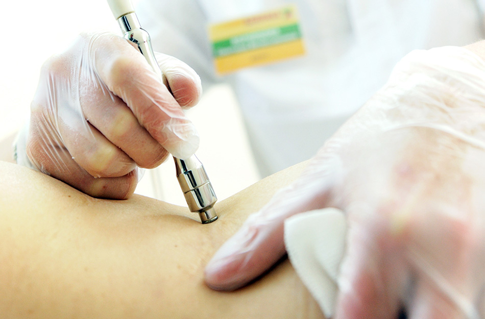 Dermal Fillers