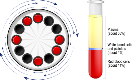 PRP Preparation Using Advanced Technology