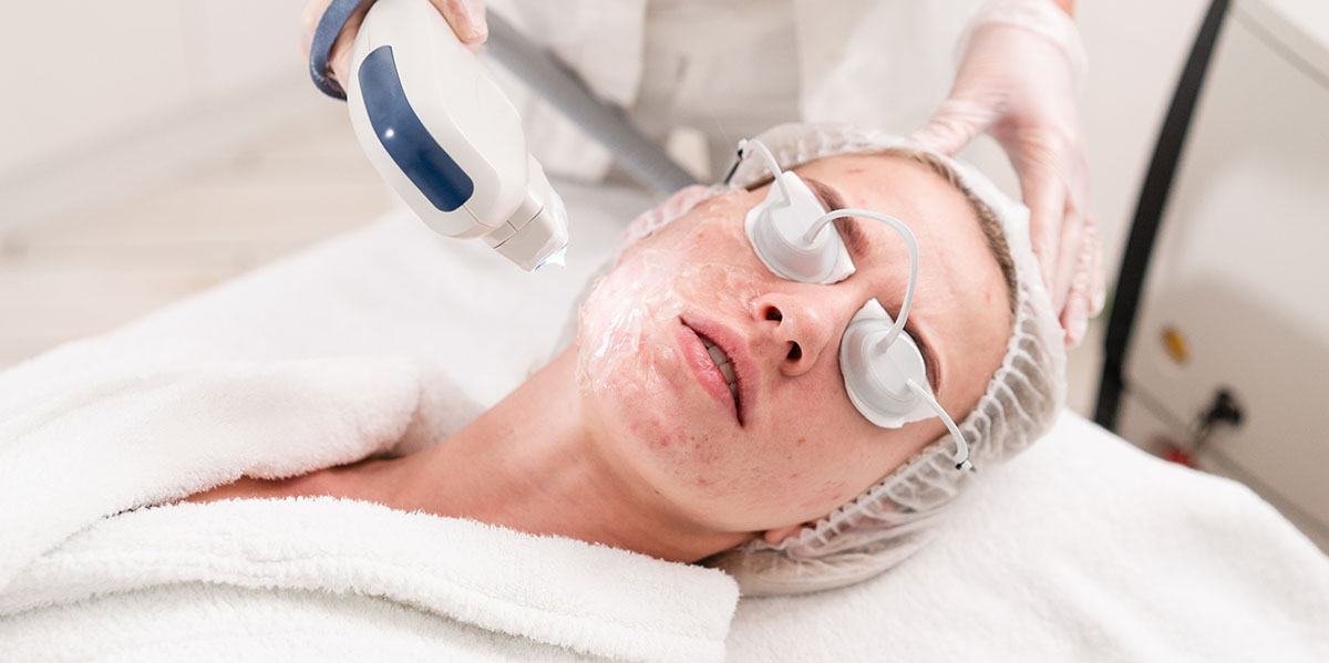 How Much Does Laser Acne Scar Removal Cost in NYC