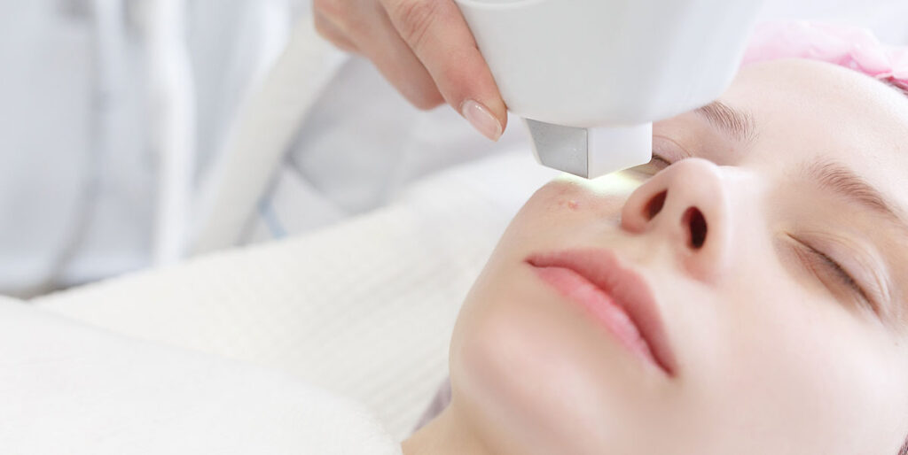 What Is Laser Acne Scar Removal?