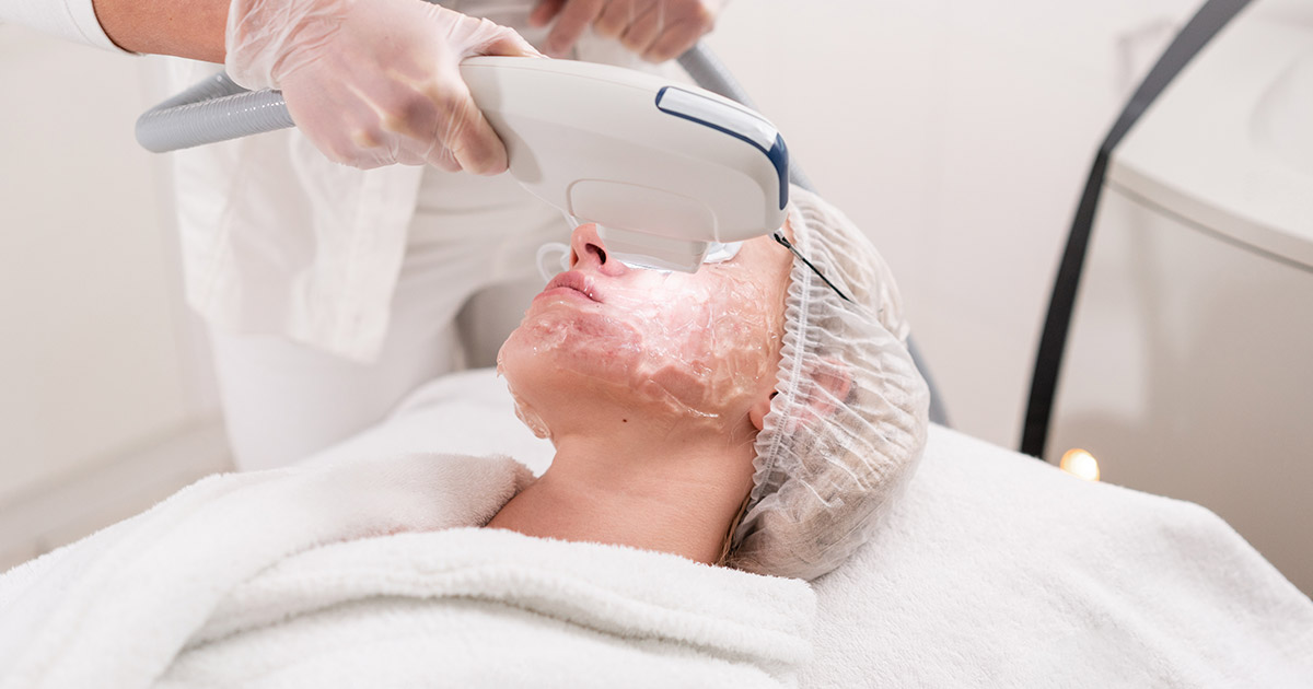 CO2 laser skin resurfacing cost