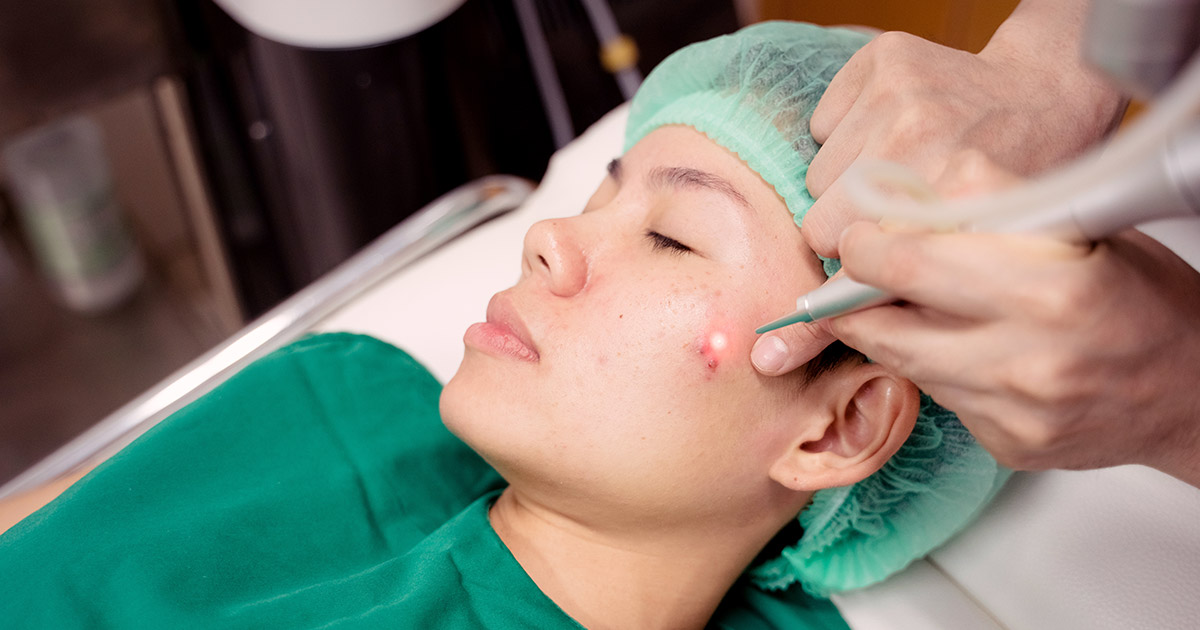 CO₂ laser resurfacing cost