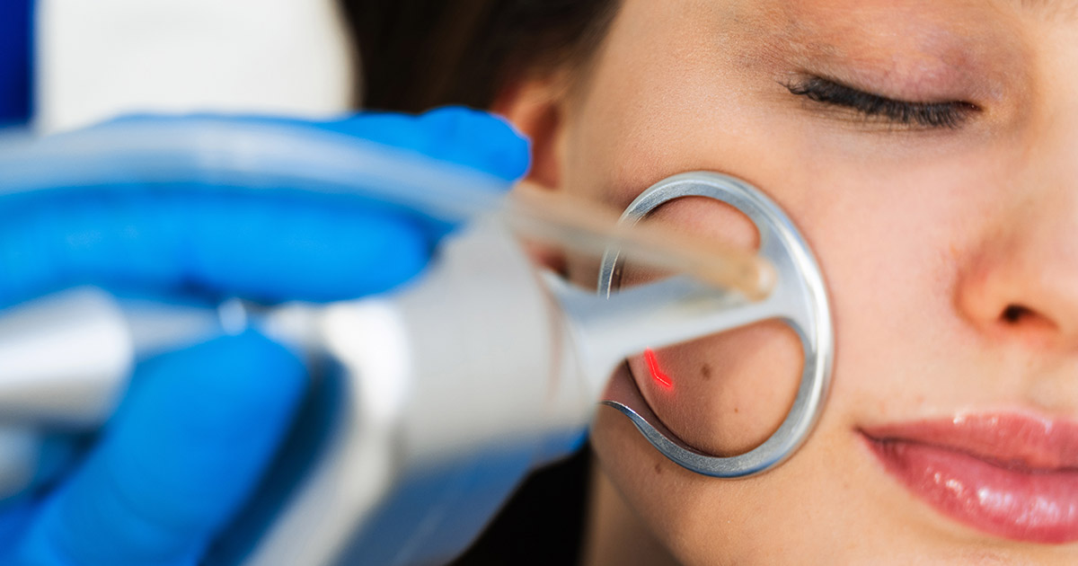 Breaking Down the Cost of CO2 Laser Resurfacing for Full Face