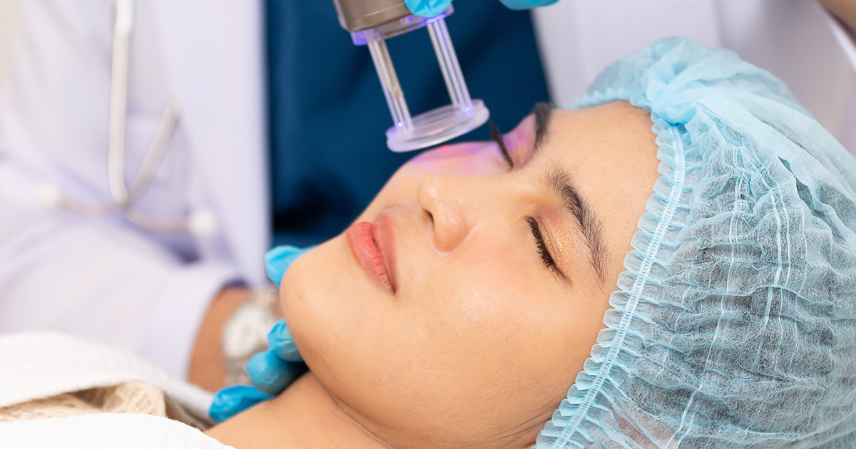 Breaking Down the Cost of CO2 Laser Resurfacing for Under Eyes
