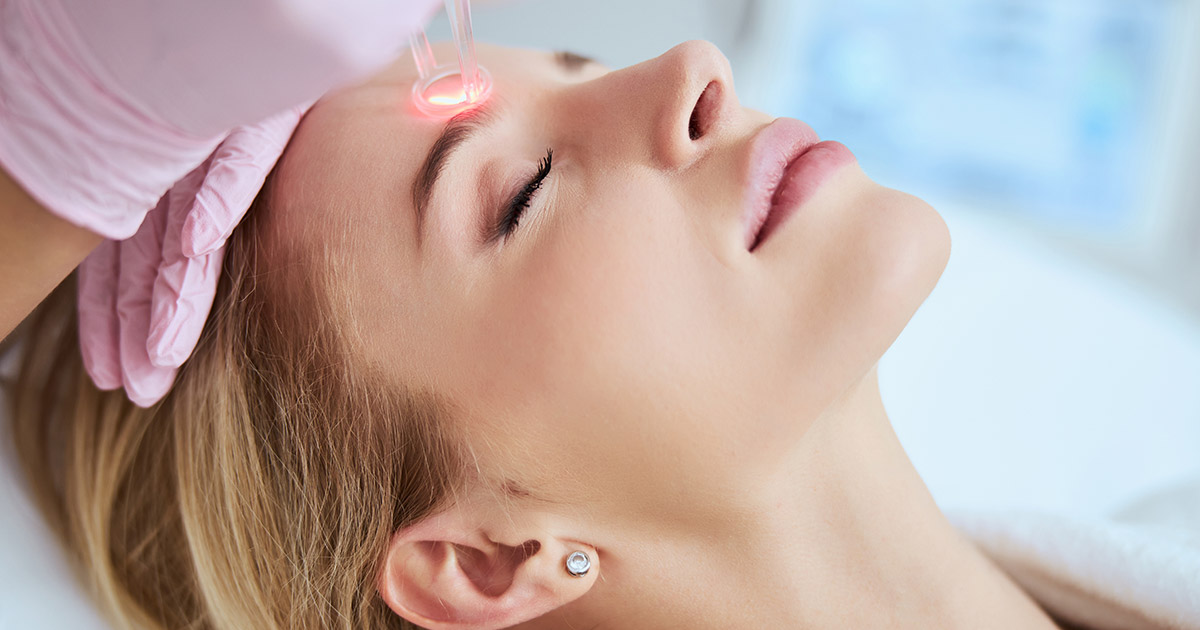 CO2 Laser Resurfacing Treatment