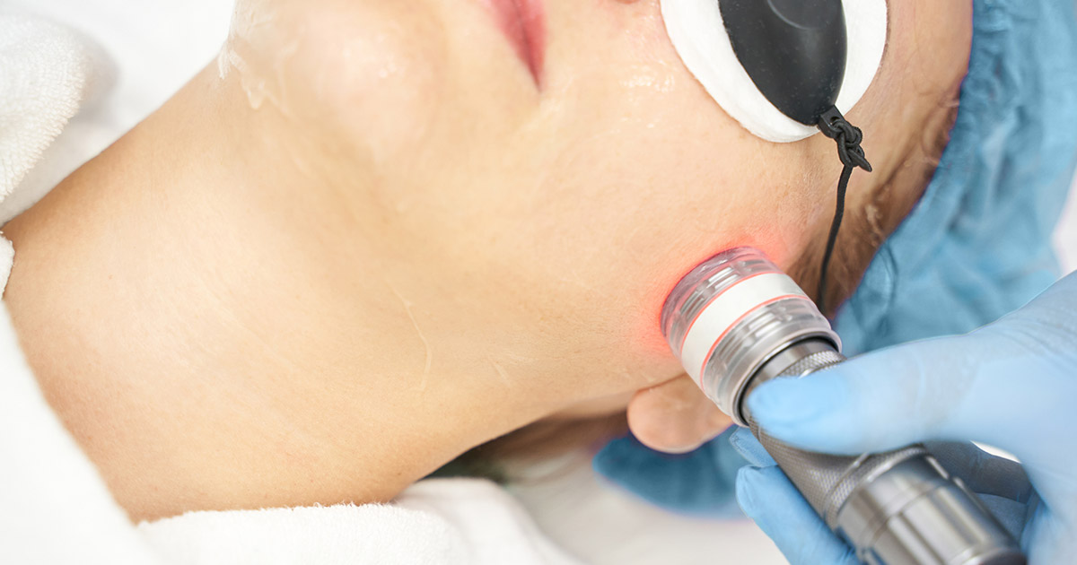 How to Get Rid of Acne Scar Bumps and Cystic Acne Scars