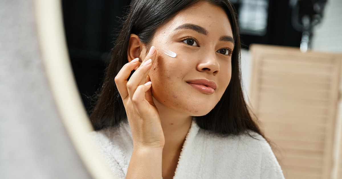 How to Prevent Acne Marks & Scars From Forming