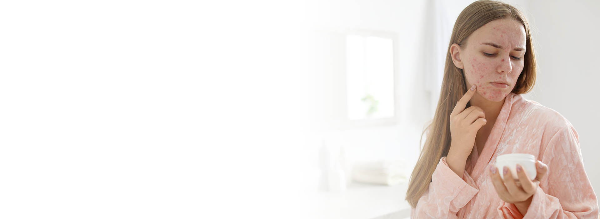 How to Prepare for Acne Scar Treatment