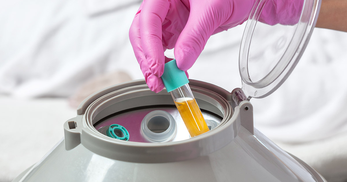 What Factors Affect the O Shot Procedure Cost